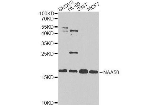 NAA50 抗体  (AA 1-169)