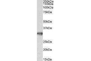 Image no. 2 for anti-Golgi phosphoprotein 3 (Coat-Protein) (GOLPH3) (Internal Region) antibody (ABIN5539831)