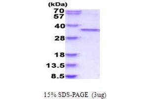 Image no. 1 for Cyclin-Dependent Kinase 1 (CDK1) (AA 1-297) protein (His tag) (ABIN5853963)