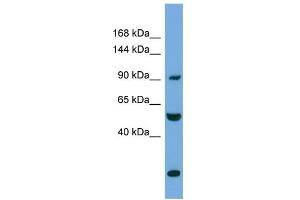 Image no. 1 for anti-Exocyst Complex Component 1 (EXOC1) (N-Term) antibody (ABIN2787382)