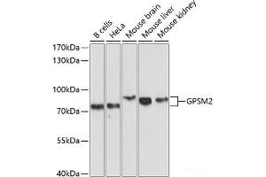 Western blot analysis of extracts of various cell lines using GPSM2 Polyclonal Antibody at dilution of 1:1000.