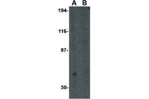 Image no. 3 for anti-Formin Binding Protein 1-Like (FNBP1L) (N-Term) antibody (ABIN6656713)