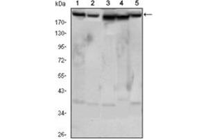 Image no. 4 for anti-RPTOR Independent Companion of mTOR, Complex 2 (RICTOR) antibody (ABIN1108880)