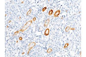 Image no. 2 for anti-Basal Cell Adhesion Molecule (Lutheran Blood Group) (BCAM) (AA 1-547) antibody (ABIN1996179)