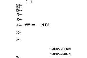 Image no. 2 for anti-Inhibin, beta B (INHBB) (C-Term) antibody (ABIN3187910)