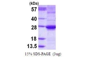 Image no. 1 for ADP-Ribosylation Factor-Like 15 (ARL15) (AA 1-204) protein (His tag) (ABIN667965)