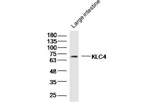 Image no. 1 for anti-Kinesin Light Chain 4 (KLC4) (AA 51-150) antibody (ABIN5675229)