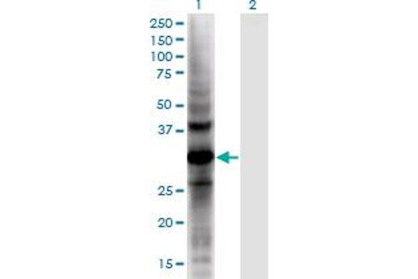 anti-Aldo-Keto Reductase Family 1, Member E2 (AKR1E2) (AA 1-307) antibody