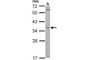 Image no. 1 for anti-OTU Domain, Ubiquitin Aldehyde Binding 1 (OTUB1) (Center) antibody (ABIN2855245)