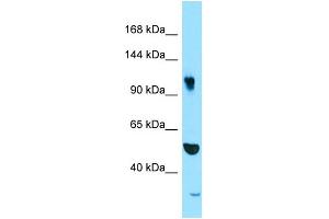 Image no. 1 for anti-Synergin gamma (SYNRG) (N-Term) antibody (ABIN2790385)