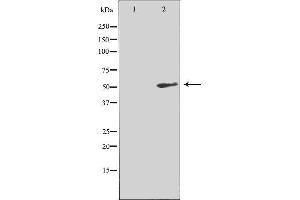 Image no. 2 for anti-Tachykinin Receptor 3 (TACR3) (C-Term) antibody (ABIN6257538)