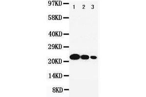 Image no. 1 for anti-Interleukin 6 (IL6) (AA 195-212), (C-Term) antibody (ABIN3043090)