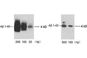 Image no. 1 for anti-Amyloid beta (Abeta) (AA 1-40) antibody (ABIN1573929)