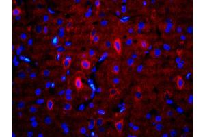 Image no. 3 for anti-Aldehyde Dehydrogenase 1 Family, Member A2 (ALDH1A2) (AA 441-518) antibody (ABIN702505)