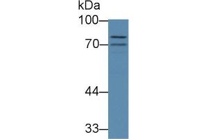 Image no. 1 for anti-ATP-Binding Cassette, Sub-Family B (MDR/TAP), Member 8 (ABCB8) (AA 468-717) antibody (ABIN5013188)