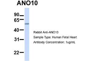 anti-Anoctamin 10 (ANO10) (C-Term) antibody