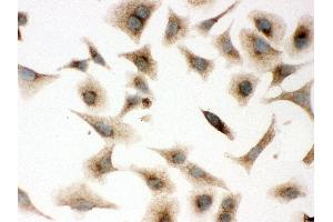 Image no. 3 for anti-Caveolin 1, Caveolae Protein, 22kDa (CAV1) (AA 4-178) antibody (ABIN3043803)