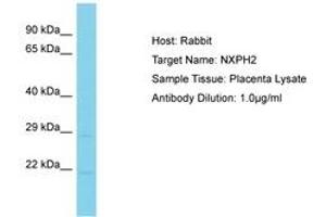 Image no. 1 for anti-Neurexophilin 2 (NXPH2) (AA 161-210) antibody (ABIN6750586)