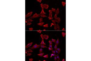 Image no. 2 for anti-Adenylosuccinate Synthase (ADSS) antibody (ABIN2560962)