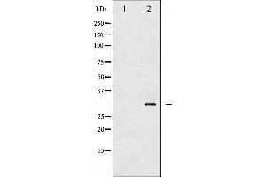 Image no. 2 for anti-14-3-3 zeta (YWHAZ) (pThr232) antibody (ABIN6256515)