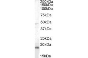 Image no. 2 for anti-Brain and Acute Leukemia, Cytoplasmic (BAALC) (Internal Region) antibody (ABIN334357)
