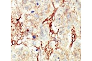 Image no. 2 for anti-Fibroblast Growth Factor Receptor 3 (FGFR3) (AA 776-806) antibody (ABIN3030957)