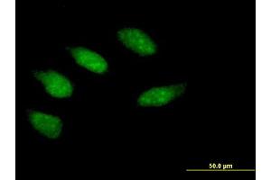 Image no. 1 for anti-Early Growth Response 2 (EGR2) (AA 1-476) antibody (ABIN515192)
