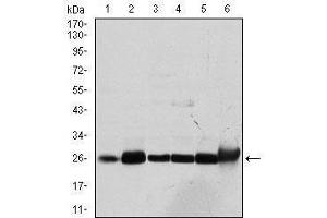 Image no. 2 for anti-Glutathione S-Transferase mu 1 (GSTM1) antibody (ABIN1107460)