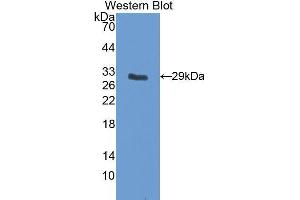 Image no. 1 for anti-Insulin-Like Growth Factor Binding Protein 5 (IGFBP5) (AA 25-271) antibody (ABIN1078205)
