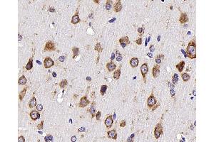 Immunohistochemistry analysis of parafffin-embedded rat brain using NTS Polyclonal Antibody at dilution of 1:300.