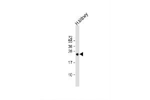 Image no. 4 for anti-Methionine Sulfoxide Reductase A (MSRA) (AA 34-63), (N-Term) antibody (ABIN391489)