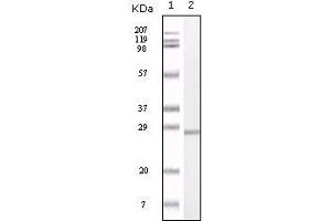 Image no. 2 for anti-S100 Calcium Binding Protein A1 (S100A1) antibody (ABIN1724663)