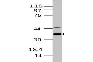 Image no. 1 for anti-MKI67 FHA Domain-Interacting Nucleolar Phosphoprotein (MKI67IP) (AA 90-210) antibody (ABIN5027394)