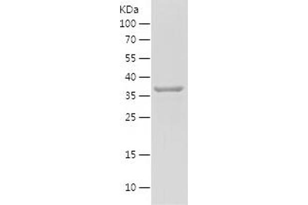 PSAT1 Protein (AA 70-191) (His-IF2DI Tag)