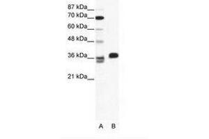 Image no. 1 for anti-ESX Homeobox 1 (ESX1) (AA 35-84) antibody (ABIN202443)