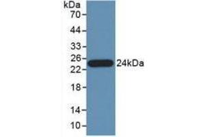 Image no. 4 for anti-Pancreas Specific Transcription Factor, 1a (PTF1A) (AA 177-328) antibody (ABIN2918928)