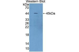 Image no. 1 for anti-Calcium/calmodulin-Dependent Protein Kinase I (CAMK1) (AA 1-370) antibody (ABIN5013280)