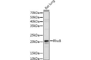 RHOB anticorps  (C-Term)