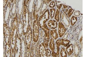 ABIN6274507 at 1/100 staining Human kidney tissue by IHC-P.