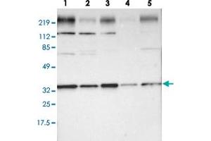 Image no. 1 for anti-Syntaxin 4 (STX4) antibody (ABIN5588971)