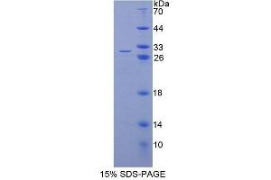 Image no. 1 for Transcription Elongation Factor A2 (TCEA2) (AA 1-218) protein (His tag) (ABIN6239527)
