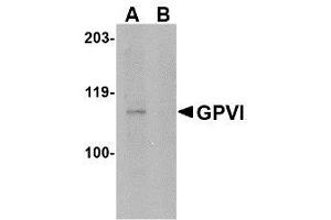Image no. 1 for anti-Glycoprotein VI (Platelet) (GP6) (Internal Region) antibody (ABIN342706)