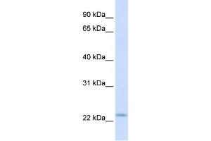 Image no. 2 for anti-Receptor Accessory Protein 1 (REEP1) (C-Term) antibody (ABIN2783893)
