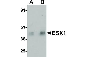 Image no. 1 for anti-ESX Homeobox 1 (ESX1) (Internal Region) antibody (ABIN6655411)