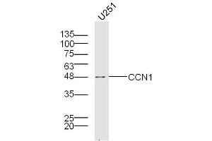 Image no. 1 for anti-Cysteine-Rich, Angiogenic Inducer, 61 (CYR61) (AA 251-379) antibody (ABIN674499)