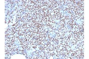 Image no. 6 for anti-Spleen Focus Forming Virus (SFFV) Proviral Integration Oncogene Spi1 (SPI1) (AA 16-170) antibody (ABIN6940631)
