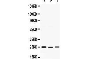 Image no. 3 for anti-Second Mitochondria-Derived Activator of Caspase (DIABLO) (AA 56-239) antibody (ABIN3044515)