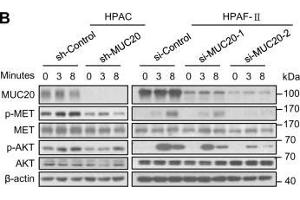 MUC20 knockdown inhibits HGF/MET signalling in PDAC cells.