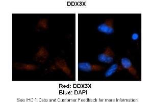 Image no. 1 for anti-DEAD (Asp-Glu-Ala-Asp) Box Polypeptide 3, X-Linked (DDX3X) (N-Term) antibody (ABIN2775180)