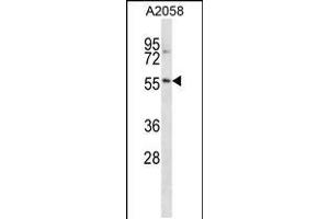Image no. 1 for anti-BTB (POZ) Domain Containing 14A (BTBD14A) (AA 473-502), (C-Term) antibody (ABIN5532952)
